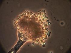Enzyme ohne Markergene